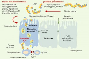 Allergies et intolérances alimentaires